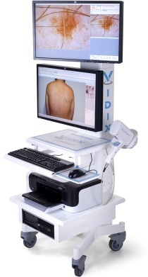 videodermatoscopio